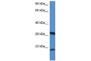 Western Blot showing Rhebl1 antibody used at a concentration of 1.
