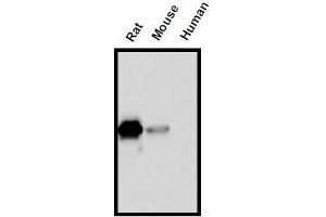 Western Blotting (WB) image for anti-Interleukin 18 (IL18) (AA 37-194) antibody (ABIN1449292) (IL-18 抗体  (AA 37-194))