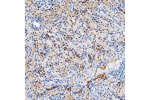 IHC analysis of SNRNP200 using anti-SNRNP200 antibody (ABIN7602032). (SNRNP200 抗体  (AA 557-2129))