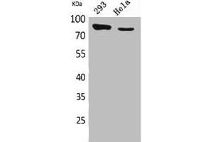 Western Blot analysis of 293, HeLa cells using DRA Polyclonal Antibody. (SLC26A3 抗体  (C-Term))