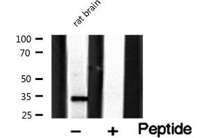 Western Blotting (WB) image for anti-Melanoma Antigen Family A, 1 (Directs Expression of Antigen MZ2-E) (MAGEA1) (C-Term) antibody (ABIN6263071)