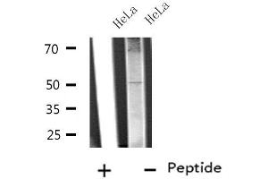 Western blot analysis of extracts from HeLa cells, using SLC38A2 antibody. (SLC38A2 抗体  (Internal Region))