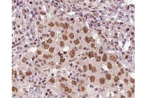 ABIN6266816 at 1/100 staining human liver tissue sections by IHC-P. (XRN2 抗体)