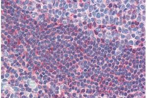 Human Tonsil (formalin-fixed, paraffin-embedded) stained with GSC antibody ABIN462175 followed by biotinylated goat anti-rabbit IgG secondary antibody ABIN481713, alkaline phosphatase-streptavidin and chromogen. (GSC 抗体  (AA 35-84))