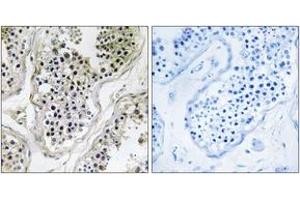 Immunohistochemistry analysis of paraffin-embedded human testis tissue, using ATXN7L1 Antibody. (ATXN7L1 抗体  (AA 441-490))