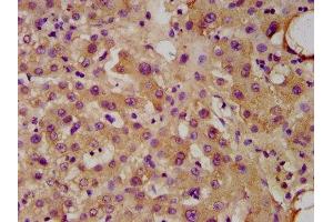 IHC image of ABIN7174623 diluted at 1:300 and staining in paraffin-embedded human liver tissue performed on a Leica BondTM system. (UGT1A1 抗体  (AA 395-482))