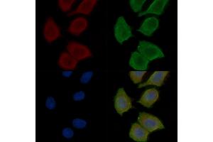 ABIN7096890 and ABIN7100956 staining Hela cells(30 min of UV treatment) by IF/ICC.