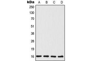 Western blot analysis of TSC22 expression in MCF7 (A), HeLa (B), mouse liver (C), rat liver (D) whole cell lysates. (TSC22D1 抗体  (C-Term))