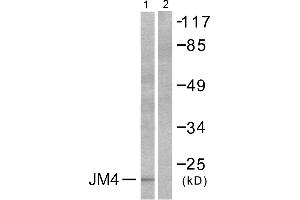 Western blot analysis of extracts from LOVO cells, using JM4 antibody (#C0238). (PRAF2 抗体)
