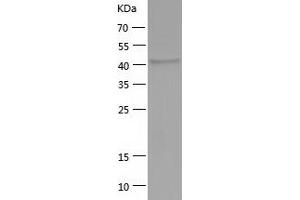 Western Blotting (WB) image for Indoleamine 2,3-Dioxygenase 2 (IDO2) (AA 15-420) protein (His tag) (ABIN7123420)