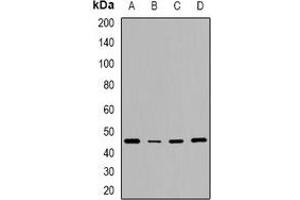 Western blot analysis of CD240d expression in HeLa (A), NIH3T3 (B), mouse brain (C), rat brain (D) whole cell lysates.