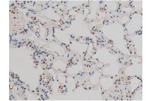 ABIN6267411 at 1/200 staining Rat lung tissue sections by IHC-P. (JunD 抗体  (pSer255))