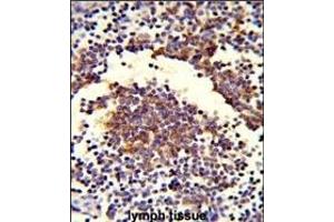 Formalin-fixed and paraffin-embedded human lymph tissue reacted with C7 Antibody (Center), which was peroxidase-conjugated to the secondary antibody, followed by DAB staining. (C7 抗体  (Center))