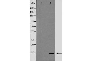 Western blot analysis of Trefoil factor 2（TFF2） expression in HeLa cells,The lane on the left is treated with the antigen-specific peptide. (Trefoil Factor 2 抗体  (Internal Region))
