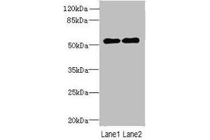 Western blot All lanes: TRMT6 antibody at 4 μg/mL Lane 1: U251 whole cell lysate Lane 2: HepG2 whole cell lysate Secondary Goat polyclonal to rabbit IgG at 1/10000 dilution Predicted band size: 56, 45, 41, 37 kDa Observed band size: 56 kDa (TRMT6 抗体  (Catalytic Subunit))
