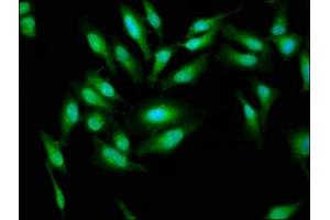 Immunofluorescence staining of Hela cells with ABIN7143628 at 1:33, counter-stained with DAPI. (AARS 抗体  (AA 164-321))