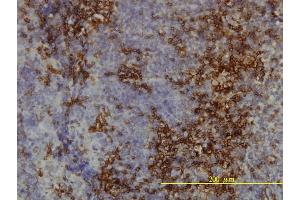 Immunoperoxidase of monoclonal antibody to LY6H on formalin-fixed paraffin-embedded human tonsil tissue. (LY6H 抗体  (AA 26-140))