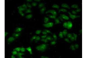 IHC-P analysis of Human HeLa cells, with FITC staining. (CAPNL1 抗体  (AA 387-694))