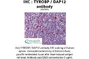 Image no. 1 for anti-TYRO Protein tyrosine Kinase Binding Protein (TYROBP) (Internal Region) antibody (ABIN1740506) (TYROBP 抗体  (Internal Region))