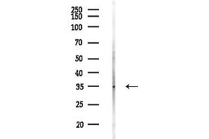 Western blot analysis of lysates from Hela cells(starvation,24h treatment), using KIR2DL4 Antibody at 1/1000 dilution.