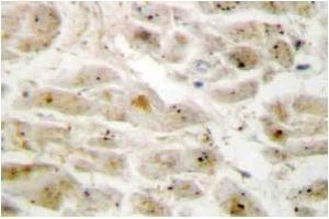 Immunohistochemistry: LIMK2 antibody staining of Paraffin-Embedded Human brain tissue. (LIMK2 抗体)