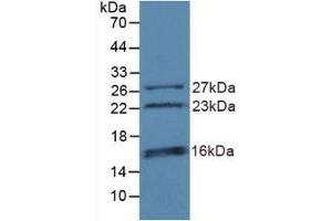 Detection of Recombinant CHD3, Human using Polyclonal Antibody to Chromodomain Helicase DNA Binding Protein 3 (CHD3) (CHD3 抗体  (AA 1551-1742))