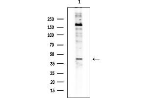Western blot analysis of lysates from Rat brain, using St3Gal-III Antibody at 1/1000 dilution.