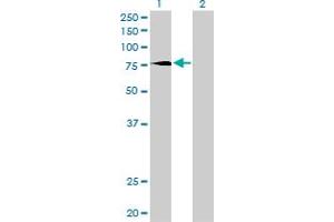 Western Blot analysis of PRKCD expression in transfected 293T cell line by PRKCD monoclonal antibody (M02), clone 6A2. (PKC delta 抗体  (AA 577-676))