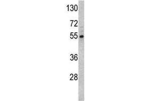 Western blot analysis of Fascin antibody and Y79 lysate. (Fascin 抗体  (AA 322-350))