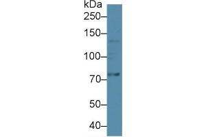 Detection of ADAMTS5 in Human A549 cell lysate using Polyclonal Antibody to A Disintegrin And Metalloproteinase With Thrombospondin 5 (ADAMTS5)
