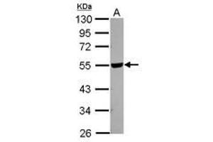 Image no. 1 for anti-Hyaluronidase-2 (HYAL2) (Internal Region) antibody (ABIN1496055) (HYAL2 抗体  (Internal Region))