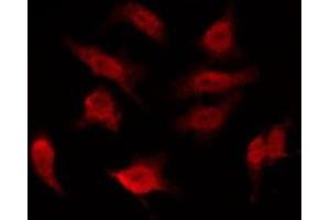 ABIN6276017 staining 293 by IF/ICC. (GPR156 抗体  (Internal Region))
