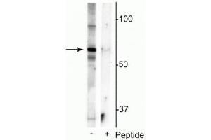 Western blot of mouse whole brain lysate showing specific immunolabeling of the ~55 kDa truncated MeCP2 protein phosphorylated at Ser421 in the first lane (-). (MECP2 抗体  (pSer421))