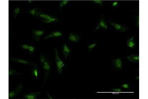 Immunofluorescence of monoclonal antibody to HDGF on HeLa cell. (HDGF 抗体  (AA 184-240))