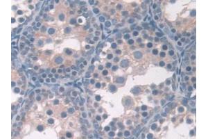 Immunohistochemistry (IHC) image for anti-Asporin (ASPN) (AA 16-373) antibody (ABIN7434827)