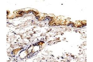 Immunohistochemistry analysis of paraffin-embedded mouse skin using,KLK7 (ABIN7074396) at dilution of 1: 1600 (Kallikrein 7 抗体)