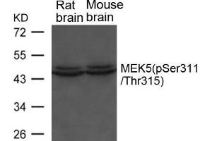 Western blot analysis of extracts from Rat and Mouse brain tissue using MEK5(phospho-Ser311/ Thr315) Antibody. (MAP2K5 抗体  (pSer311, pThr315))