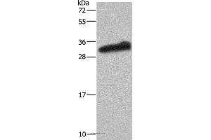 Western blot analysis of Human testis tissue, using GSTA3 Polyclonal Antibody at dilution of 1:250 (GSTA3 抗体)