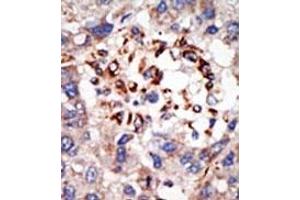 Image no. 2 for anti-Chromobox Homolog 8 (CBX8) (C-Term) antibody (ABIN357753) (CBX8 抗体  (C-Term))