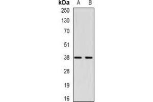 Western blot analysis of CTGF expression in Hela (A), HepG2 (B) whole cell lysates. (CTGF 抗体)