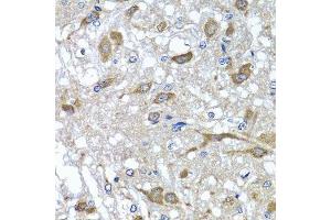 Immunohistochemistry of paraffin-embedded rat brain using OSGEPL1 antibody. (OSGEPL1 抗体  (AA 1-270))