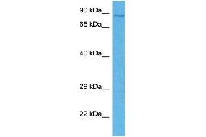 Host:  Rabbit  Target Name:  CPEB4  Sample Tissue:  Human DLD1 Whole Cell  Antibody Dilution:  1ug/ml (CPEB4 抗体  (N-Term))