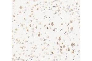 Immunohistochemistry analysis of paraffin-embedded mouse brain using,KCNF1 (ABIN7075155) at dilution of 1: 2400 (KCNF1 抗体)