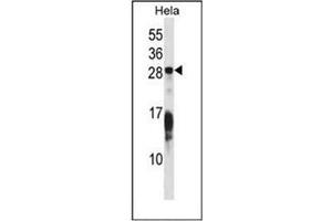 Western blot analysis of RAP1B Antibody (C-term) in Hela cell line lysates (35ug/lane). (RAP1B 抗体  (C-Term))