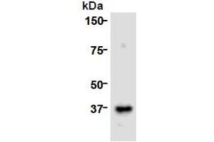 Western Blotting (WB) image for anti-Cell Division Cycle Associated 8 (CDCA8) (AA 1-280), (N-Term) antibody (ABIN1449290) (CDCA8 抗体  (N-Term))