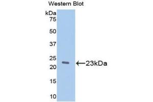 Western blot analysis of the recombinant protein. (Retinol Binding Protein 5 抗体  (AA 19-201))
