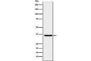 Western blot analysis of glutathione S transferase Omega 1 expression in HepG2 cell lysate.