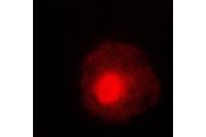 Immunofluorescent analysis of ABL1/2 (pY393/439) staining in HeLa cells. (ABL1/2 抗体  (C-Term, pTyr393, pTyr439))