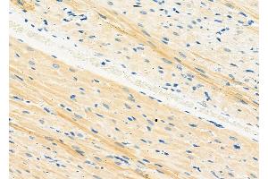 ABIN6265404 and ABIN6273174 at 1/100 staining Rat heart tissue by IHC-P.
