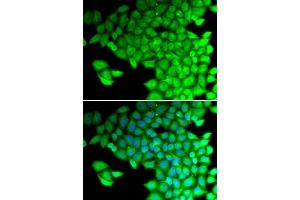 Immunofluorescence analysis of HeLa cells using MYL2 antibody. (MYL2 抗体  (AA 1-166))